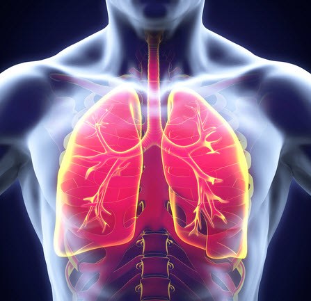 Lung disease caused by silica dust